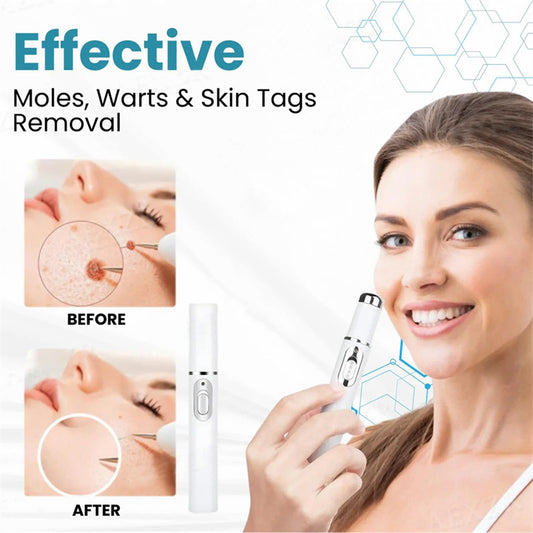 Mole and Wart Removal Pen Skin Care