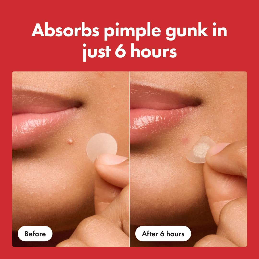 Pimple Patch